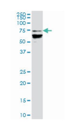 DEF6, Mouse, Polyclonal Antibody, Abnova 50 &mu;g | Buy Online | Abnova | Fisher Scientific