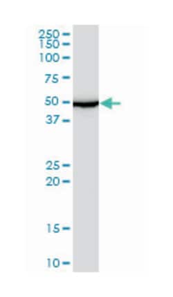 abhydrolase domain containing 5, Mouse, Polyclonal Antibody, Abnova 50&mu;L;