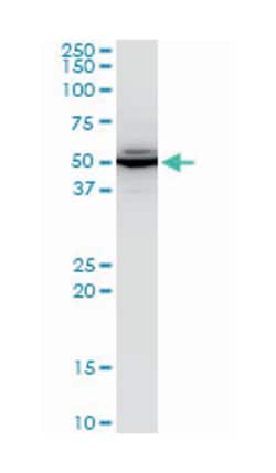 abhydrolase domain containing 5, Mouse, Polyclonal Antibody, Abnova 50&mu;L;