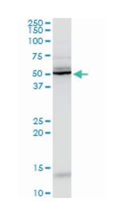 abhydrolase domain containing 5, Mouse, Polyclonal Antibody, Abnova 50&mu;L;