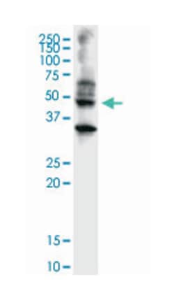 abhydrolase domain containing 5, Mouse, Clone: 1F3, Abnova 100&mu;g; Unlabeled:Antibodies,