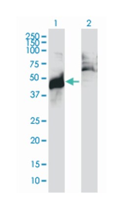 abhydrolase domain containing 5, Mouse, Clone: 1F3, Abnova 100&mu;g; Unlabeled:Antibodies,