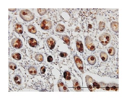 abhydrolase domain containing 5, Mouse, Clone: 1F3, Abnova 100&mu;g; Unlabeled:Antibodies,