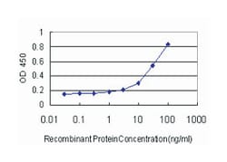 abhydrolase domain containing 5, Mouse, Clone: 1F3, Abnova 100&mu;g; Unlabeled:Antibodies,