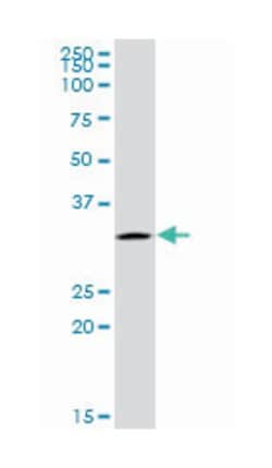UTP11-like, U3 small nucleolar ribonucleoprotein, (yeast), Mouse, Purified