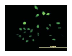 UTP11-like, U3 small nucleolar ribonucleoprotein, (yeast), Mouse, Purified