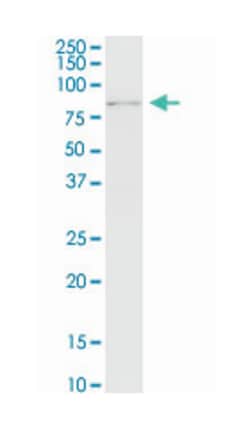 ring finger protein 12, Mouse, Clone: 1G10, Abnova 100&mu;g; Unlabeled:Antibodies,