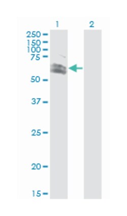ring finger protein 12, Mouse, Clone: 1G10, Abnova 100&mu;g; Unlabeled:Antibodies,