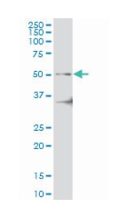 interleukin-1 receptor-associated kinase 4, Mouse, Clone: 2D3, Abnova 100 &mu;g | Buy Online | Abnova Corporation | Fisher Scientific