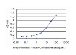 interleukin-1 receptor-associated kinase 4, Mouse, Clone: 2D3, Abnova 100 &mu;g | Buy Online | Abnova Corporation | Fisher Scientific