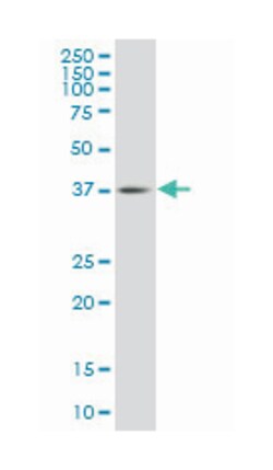 transcription factor Dp family, member 3, Mouse, Clone: 3F11, Abnova 100&mu;g;