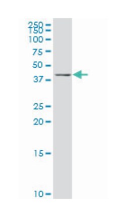 Kruppel-like factor 3 (basic), Mouse, Polyclonal Antibody, Abnova 50&mu;L;