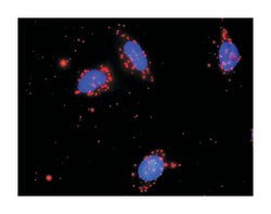 nemo-like kinase, Mouse, Clone: 2B11, Abnova 100&mu;g; Unlabeled:Antibodies,