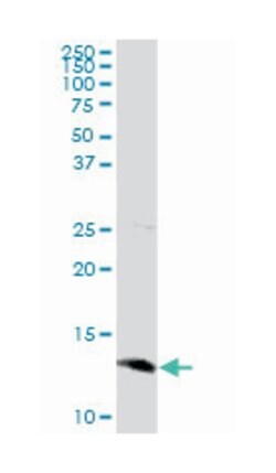 selenoprotein X, 1, Rabbit, Purified MaxPab Polyclonal Antibody, Abnova 100 &mu;g | Buy Online | Abnova Corporation | Fisher Scientific