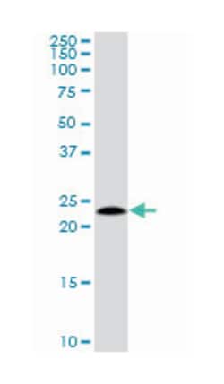 NOP16 nucleolar protein homolog (yeast), Rabbit, Purified MaxPab Polyclonal