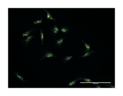 NOP16 nucleolar protein homolog (yeast), Rabbit, Purified MaxPab Polyclonal