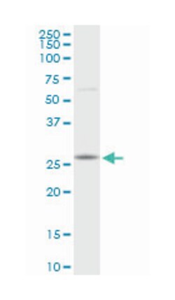 RAB23, member RAS oncogene family, Rabbit, Purified MaxPab™ Polyclonal Antibody, Abnova™