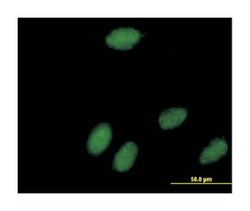 polymerase (RNA) III (DNA directed) polypeptide K, 12.3kDa (B01), Mouse anti-Human, Polyclonal Antibody, Abnova 50 &mu;L | Buy Online | Abnova | Fisher Scientific