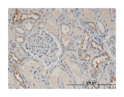 CALML5, Mouse, Clone: 2F10, Abnova 100&mu;g; Unlabeled:Antibodies, Monoclonal
