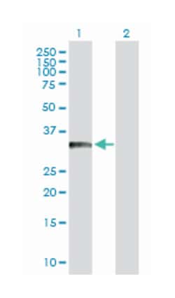 B-cell CLL/lymphoma 11A (zinc finger protein), Rabbit, Purified MaxPab