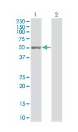 chromosome 9 open reading frame 68, Mouse, Polyclonal Antibody, Abnova