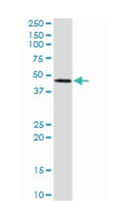 serine/threonine/tyrosine kinase 1, Rabbit, Purified MaxPab Polyclonal