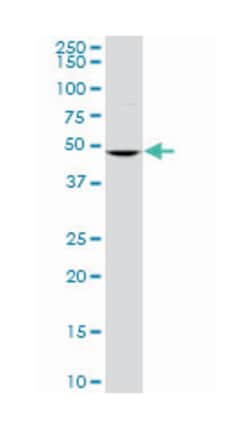 BTB (POZ) domain containing 2, Mouse, Polyclonal Antibody, Abnova 50&mu;L;