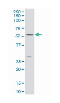 BTB (POZ) domain containing 2, Mouse, Polyclonal Antibody, Abnova 50&mu;L;