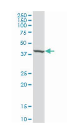SEPT3, Mouse, Clone: 1F6, Abnova&trade;