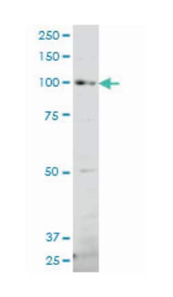 protocadherin gamma subfamily B, 7, Mouse, Polyclonal Antibody, Abnova