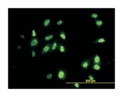 RAD18 homolog (S. cerevisiae), Mouse, Clone: 3H7, Abnova 100&mu;g; Unlabeled:Antibodies,