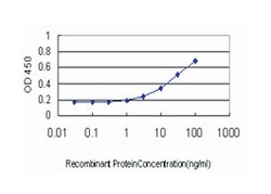 core 1 synthase, glycoprotein-N-acetylgalactosamine 3-beta-galactosyltransferase,