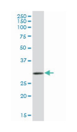 enolase-phosphatase 1, Mouse, Polyclonal Antibody, Abnova 50&mu;L; Unlabeled:Antibodies,