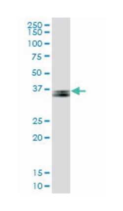 parvin, gamma, Mouse, Polyclonal Antibody, Abnova 50&mu;L; Unlabeled:Antibodies,