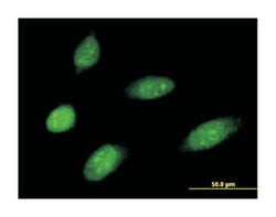 MMS19 nucleotide excision repair homolog (S. cerevisiae), Mouse, Polyclonal Antibody, Abnova 50 &mu;L | Buy Online | Abnova | Fisher Scientific