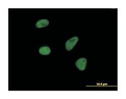THOC3, Mouse, Polyclonal Antibody, Abnova 50 &mu;g | Buy Online | Abnova Corporation | Fisher Scientific