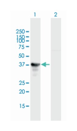 naked cuticle homolog 2 (Drosophila), Mouse, Polyclonal Antibody, Abnova