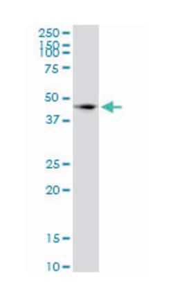 signal-regulatory protein alpha, Mouse, Clone: 4C7, Abnova 100&mu;g; Unlabeled:Antibodies,