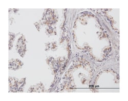 ChGn (B02P), Mouse anti-Human, Purified MaxPab Polyclonal Antibody, Abnova 50 &mu;g | Buy Online | Abnova | Fisher Scientific