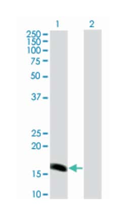 BARX homeobox 1, Mouse, Clone: 1E7, Abnova 100&mu;g; Unlabeled:Antibodies,