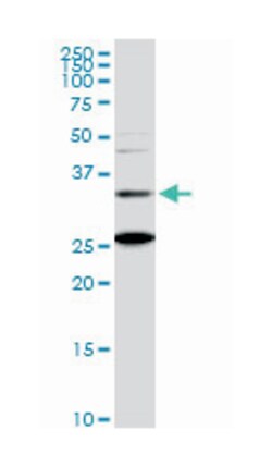 BarH-like homeobox 1, Mouse, Clone: 2B11, Abnova 100&mu;g; Unlabeled:Antibodies,