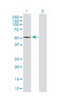 SET and MYND domain containing 2, Rabbit, Purified MaxPab Polyclonal Antibody,
