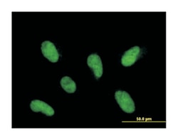 integrator complex subunit 12, Mouse, Polyclonal Antibody, Abnova 50&mu;L;