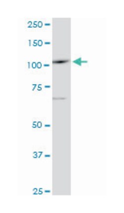 sal-like 4 (Drosophila), Mouse, Clone: 6E3, Abnova 100 &mu;g | Buy Online | Abnova Corporation | Fisher Scientific