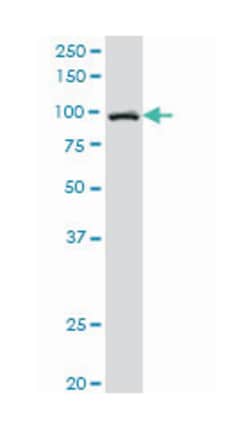 sorting nexin 14, Mouse, Polyclonal Antibody, Abnova 50&mu;L; Unlabeled:Antibodies,