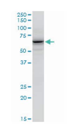 GATA zinc finger domain containing 2B (A01), Mouse anti-Human, Mouse, Polyclonal Antibody, Abnova 50 &mu;L | Buy Online | Abnova | Fisher Scientific