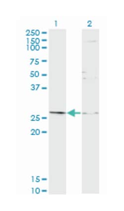 TGIF2, Mouse, Clone: 2D4, Abnova 200&mu;L; Unlabeled:Antibodies, Monoclonal