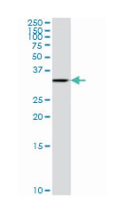 PFTAIRE protein kinase 2 (A01), Mouse anti-Human, Rat, Polyclonal Antibody, Abnova 50 &mu;L | Buy Online | Abnova | Fisher Scientific