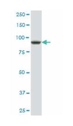 DEAD (Asp-Glu-Ala-Asp) box polypeptide 54 (A01), Mouse anti-Human, Polyclonal