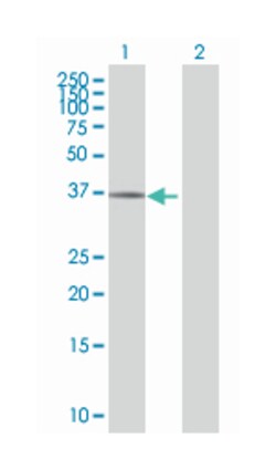 WD repeat domain 77, Mouse, Polyclonal Antibody, Abnova 50&mu;L; Unlabeled:Antibodies,